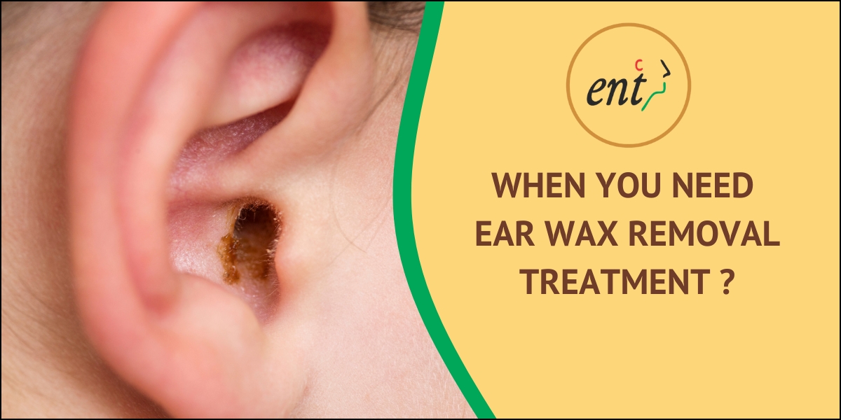 Feeling Blocked? When You Need Ear Wax Removal Treatment