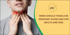 Tonsils Removal Guidelines