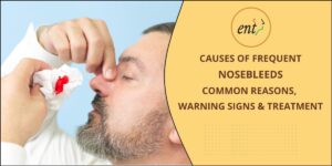 Nosebleeding - Common Reasons, Warning Signs & Treatment
